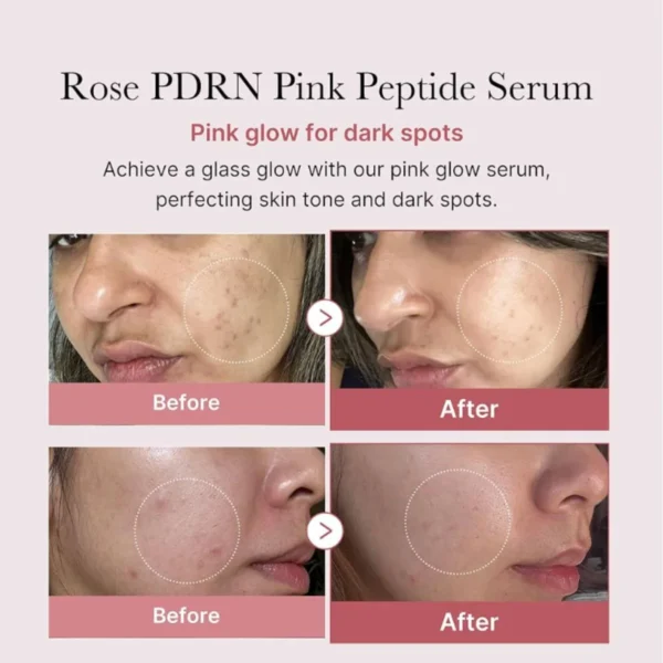 Medicube - PDRN Pink Peptide Serum 30mL – Image 2